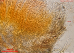 Scutellinia minor