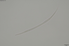 Tylenchidae