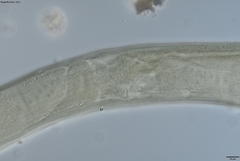 Prionchulus