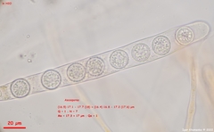 Scutellinia minor