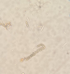 Hysterium angustatum