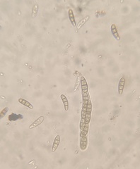 Hysterium angustatum