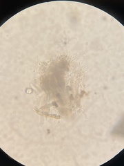 Hysterium angustatum