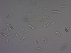 Exobasidium oxycocci