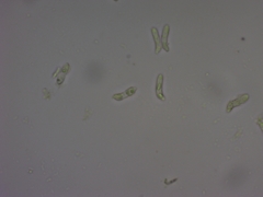 Exobasidium oxycocci