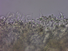 Exobasidium oxycocci