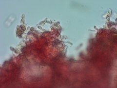 Exobasidium oxycocci
