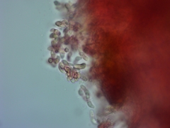 Exobasidium oxycocci