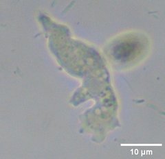 Heterolobosea