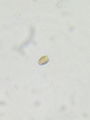 Chrysophyceae