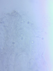 Sagaranella tylicolor