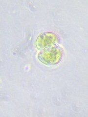 Cosmarium contractum