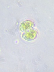 Cosmarium contractum