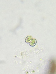 Cosmarium contractum