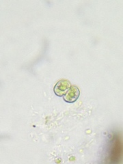 Cosmarium contractum