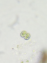 Cosmarium contractum