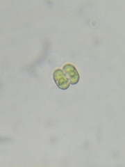 Cosmarium contractum