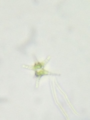 Staurastrum ankyroides