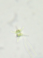 Staurastrum ankyroides