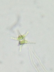 Staurastrum ankyroides