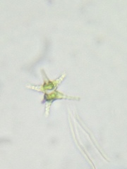 Staurastrum ankyroides