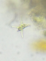 Staurastrum ankyroides