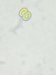 Cosmarium contractum