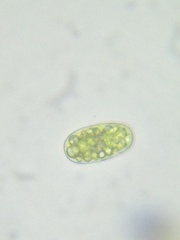 Botrydiopsis