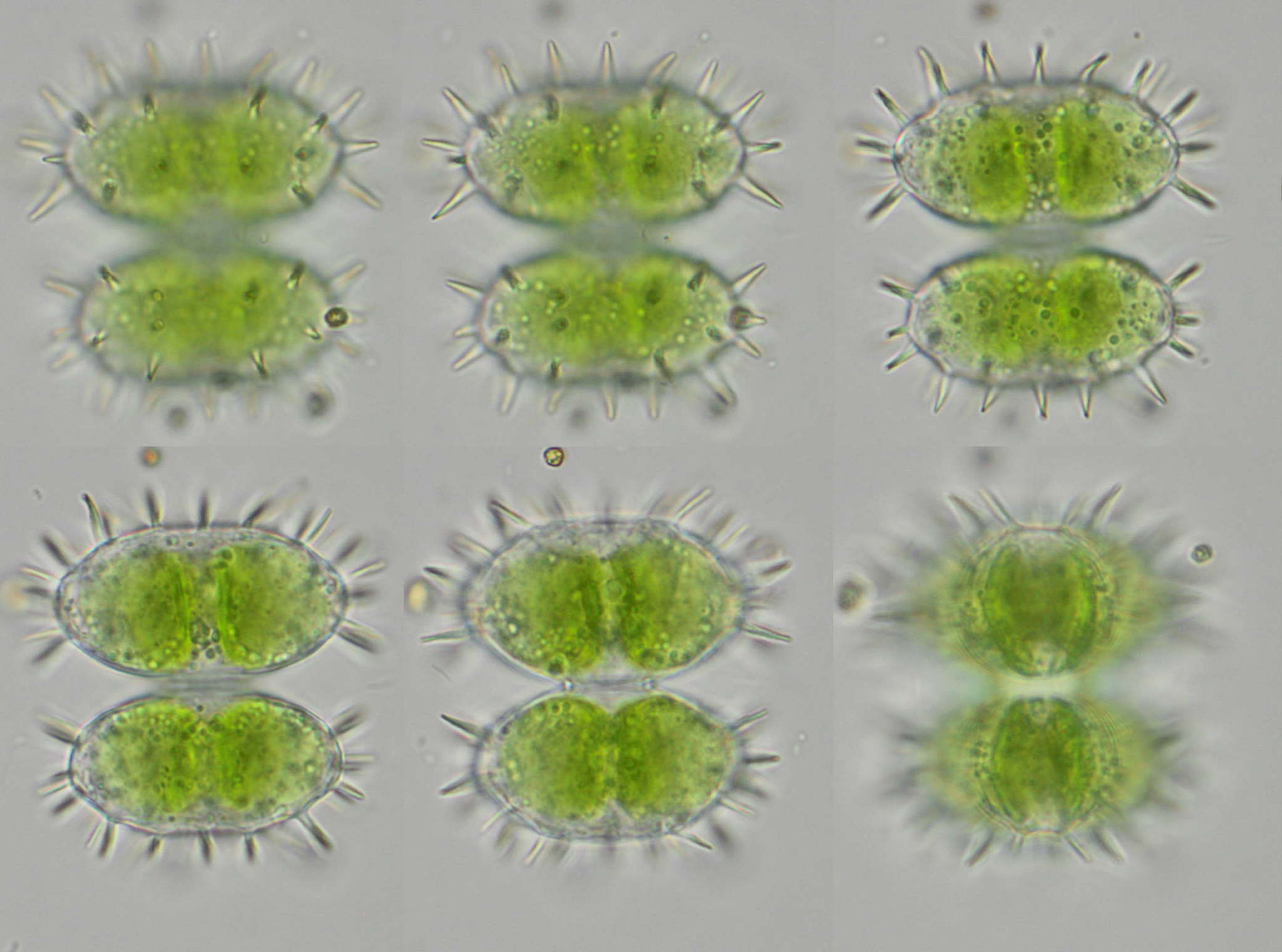 Staurastrum teliferum