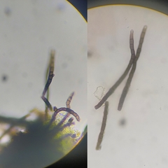 Taeniolella phaeophysciae