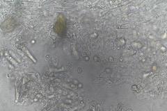 Entoloma albidocoeruleum