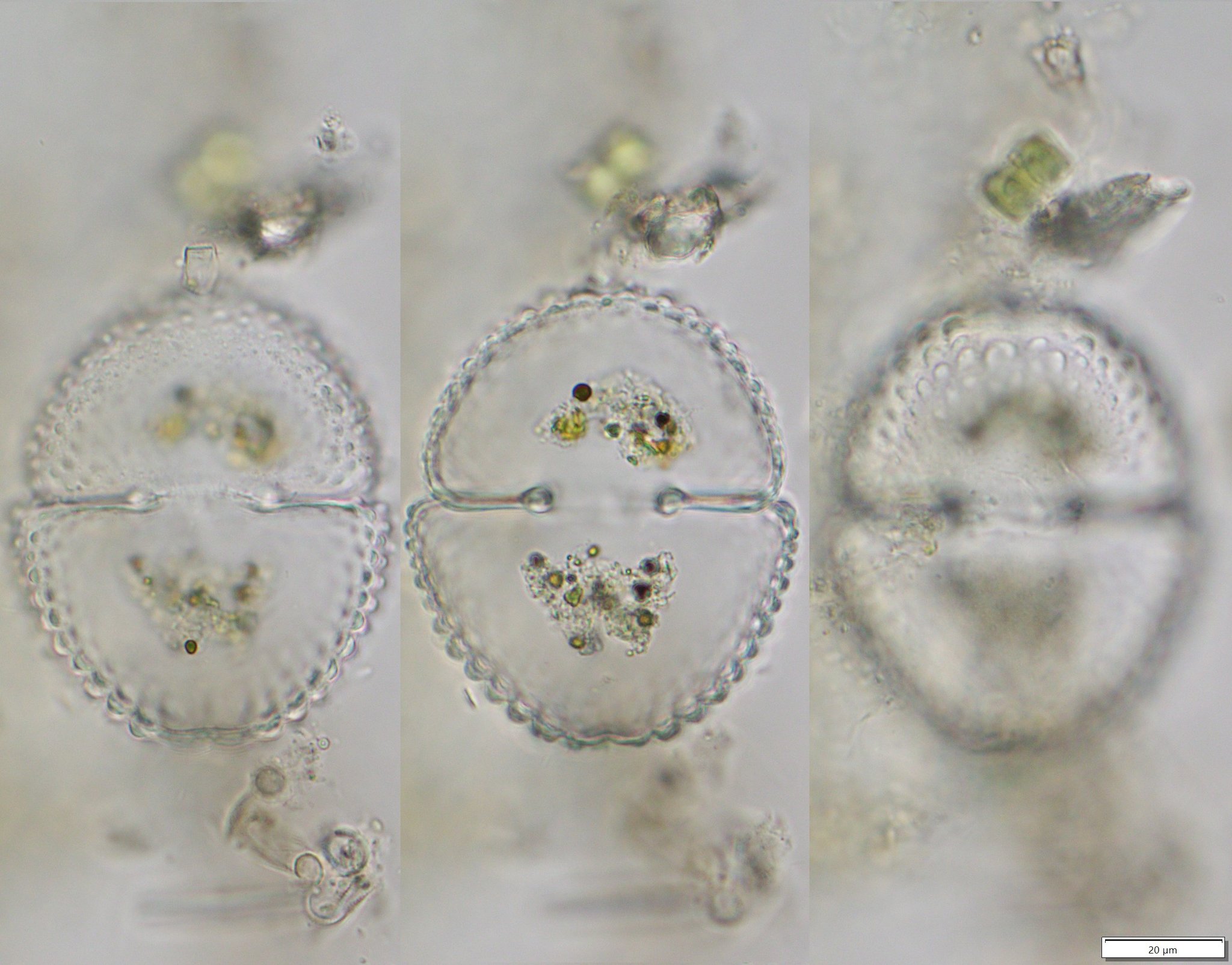 Cosmarium hornavanense