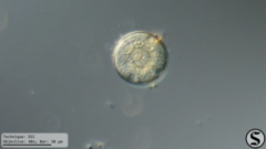 Arcella hemisphaerica