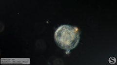 Arcella hemisphaerica