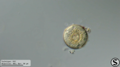 Arcella hemisphaerica