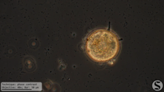 Arcella hemisphaerica