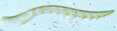 Pseudodineura fuscula