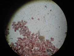 Physarum crateriforme