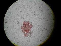 Physarum crateriforme