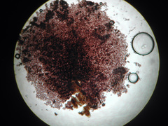 Physarum crateriforme