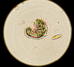 Gastrotricha