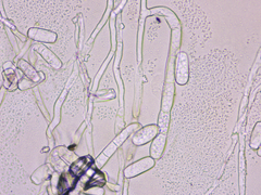 Golovinomyces sonchicola