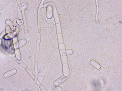 Golovinomyces sonchicola