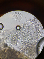 Phyllosticta cruenta