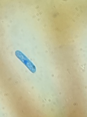 Colletotrichum