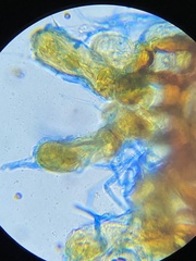 Colletotrichum
