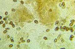 Cortinarius flexipes