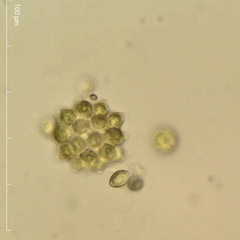 Coelastrum pulchrum