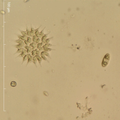 Pseudopediastrum boryanum longicorne