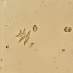 Tetradesmus